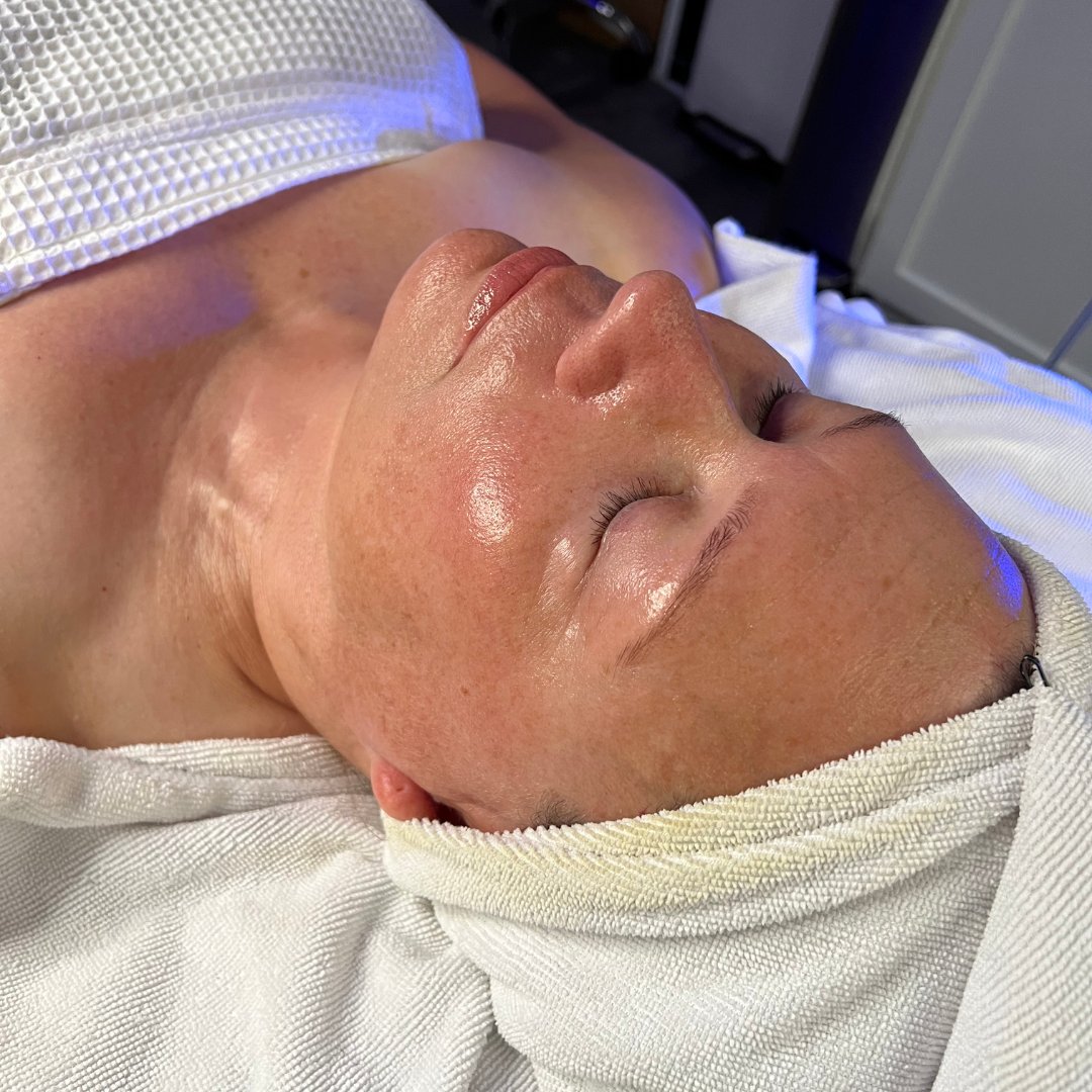 HydraFacial & Dermaplaning: The Best Summer Skincare Combo