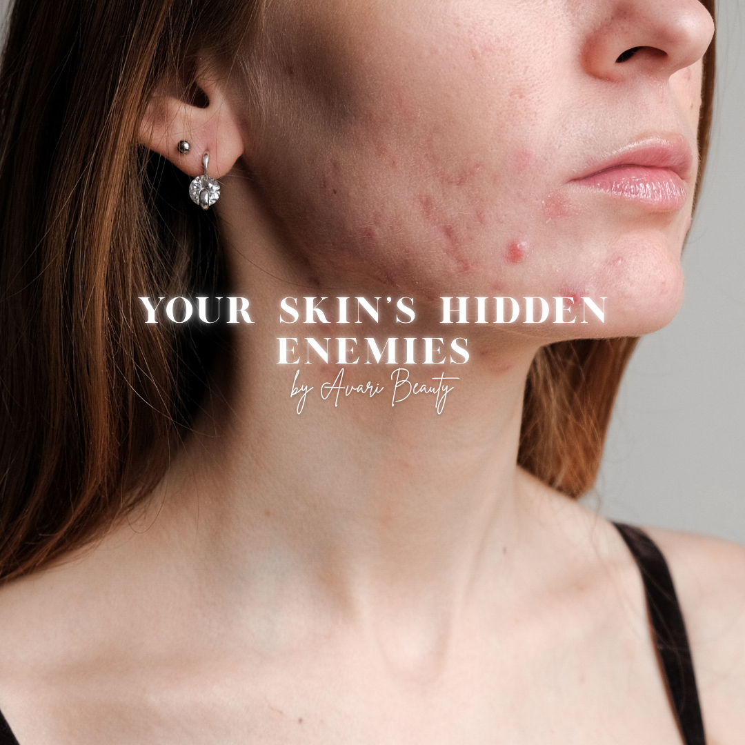 Your Skin’s Hidden Enemies: Everyday Habits That Could Be Causing Breakouts
