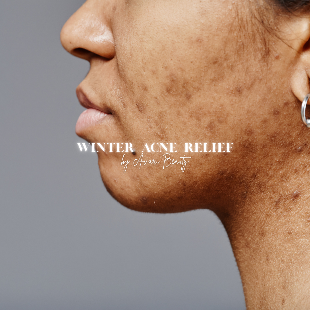 Winter Acne Relief: Clear Skin Through Balance, Barrier Care & Sustainable Beauty