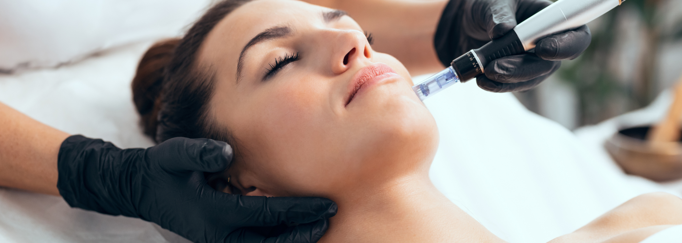 Microchanneling vs. Microneedling: Everything You Need To Know